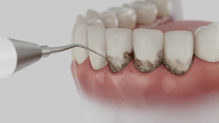 Trusted Invisalign Clear Aligners service in Five Points, FL - Dentist Open Now
